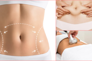 Liposukcja kawitacyjna