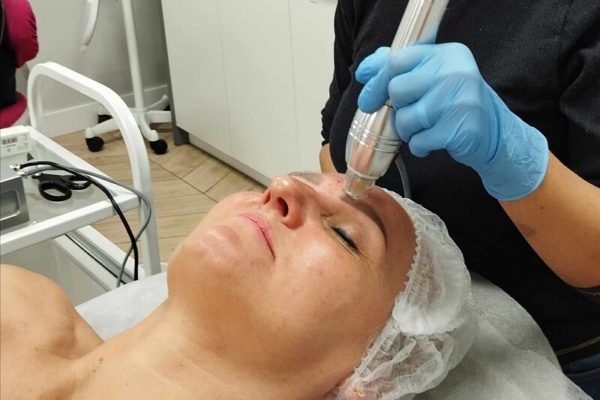 Zabiegi na twarz